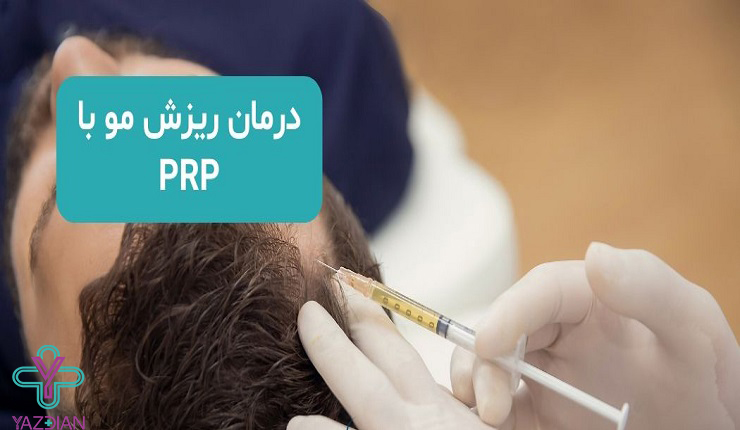 پی آر پی مو چیست؟برای چه کسانی مناسب است و چگونه عمل می‌کند